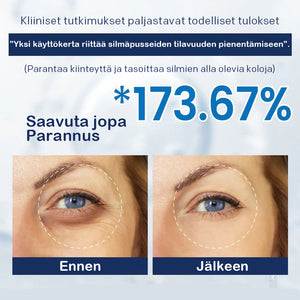 Anti-silmälaukkuvoide-💖Osta yksi saat yhden ilmaiseksi (2 kpl)💖
