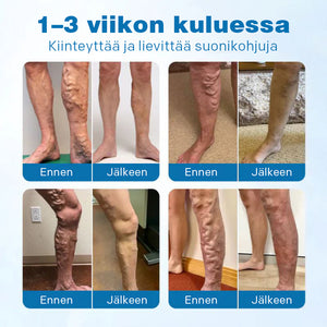 Jalkojenhoitoratkaisu