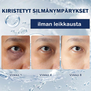 Anti-silmälaukkuvoide-💖Osta yksi saat yhden ilmaiseksi (2 kpl)💖