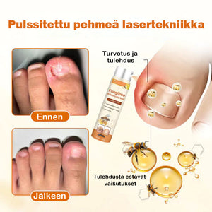 Edistynyt kynsien korjaussuihke