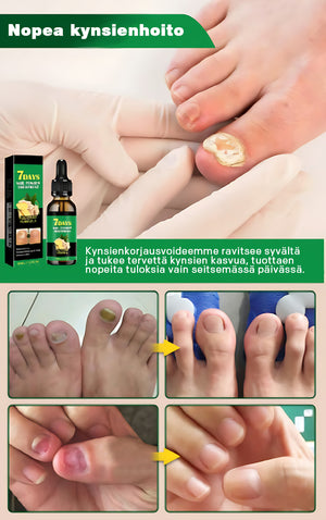 Inkiväärikynsienhoitoliuos