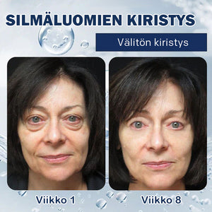 Anti-silmälaukkuvoide-💖Osta yksi saat yhden ilmaiseksi (2 kpl)💖