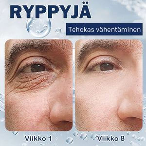 Anti-silmälaukkuvoide-💖Osta yksi saat yhden ilmaiseksi (2 kpl)💖