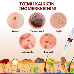 Eteesi läiskien ja luomen poistoon - Osta 1 saat 1 ilmaiseksi (2 kpl)