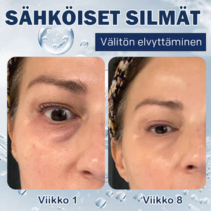Anti-silmälaukkuvoide-💖Osta yksi saat yhden ilmaiseksi (2 kpl)💖