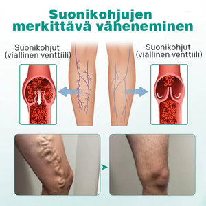 Paikalliset laastarit kohonneille suonille