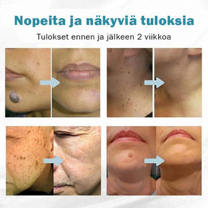 Sileä vartalonhoitokynä