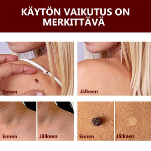 Eteesi läiskien ja luomen poistoon - Osta 1 saat 1 ilmaiseksi (2 kpl)