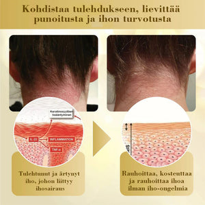Condense Mellifera Venom -ihon korjausvoide