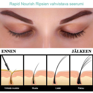 Ripsien seerumia