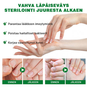 Inkiväärikynsienhoitoliuos
