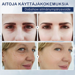 Anti-silmälaukkuvoide-💖Osta yksi saat yhden ilmaiseksi (2 kpl)💖