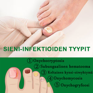 Inkiväärikynsienhoitoliuos